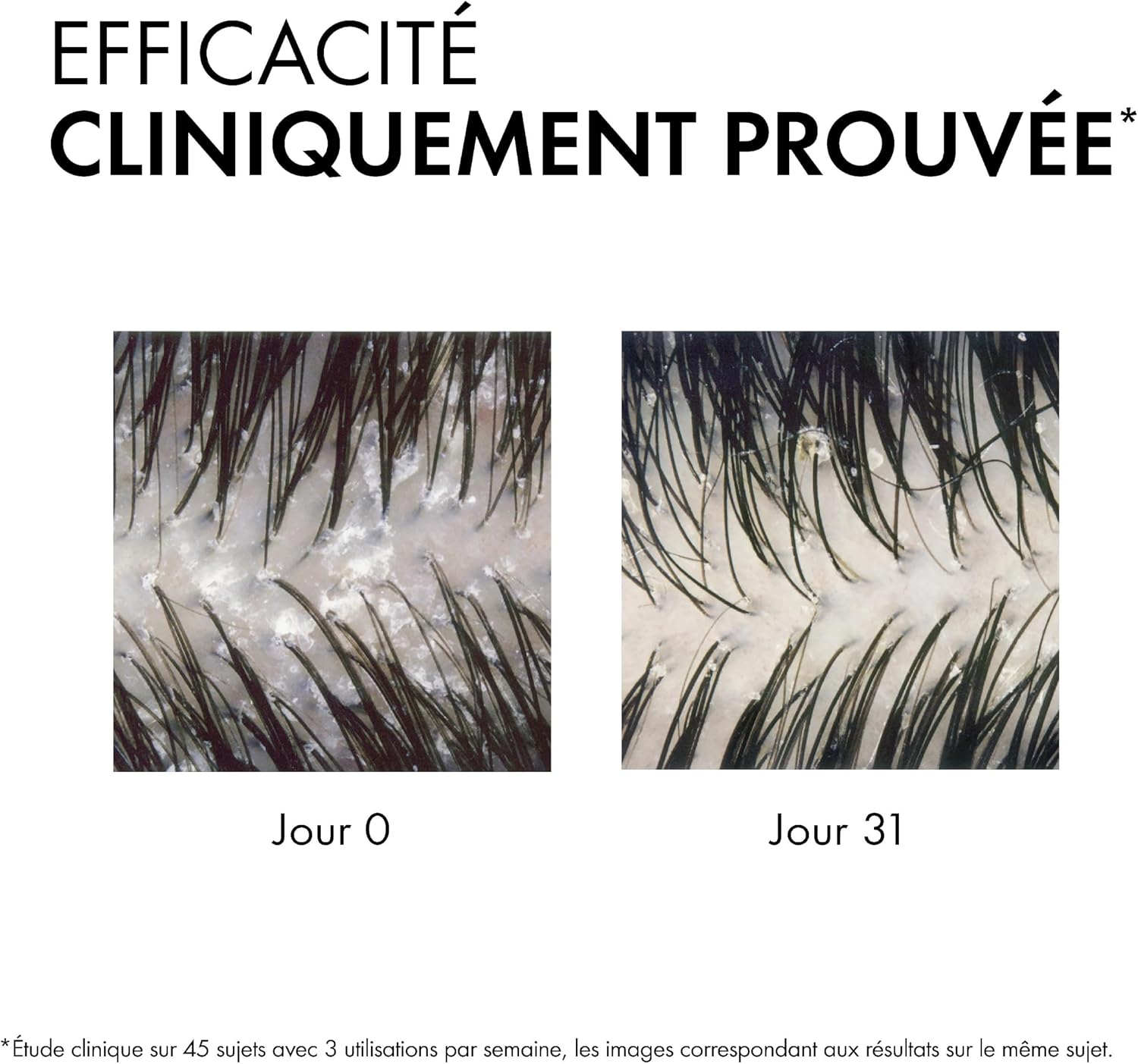 Detalle de VICHY DERCOS Shampooing Anti-Pelliculaire DS – Cheveux Normaux à Gras, Microbiome et Sélénium DS