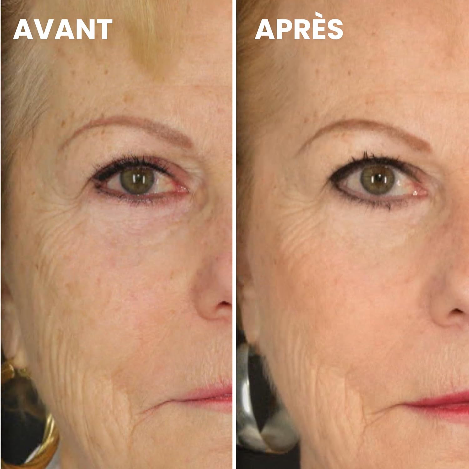 Detalle de KDERM K’DERM SCIENTIFIC PARIS Lifter Sérum Gel Réparateur anti-rides à la Kappa-Élastine et Aloe Vera – 30 ml