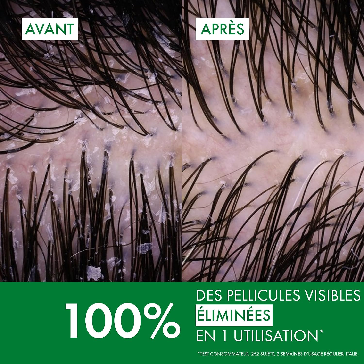 Detalle 2 de VICHY DERCOS Shampooing Anti-Pelliculaire DS – Cheveux Normaux à Gras, Microbiome et Sélénium DS